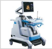 4D color Doppler ultrasound 4D color Doppler ultrasound