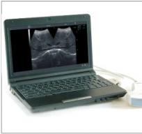 Notebook B ultrasound Notebook B ultrasound